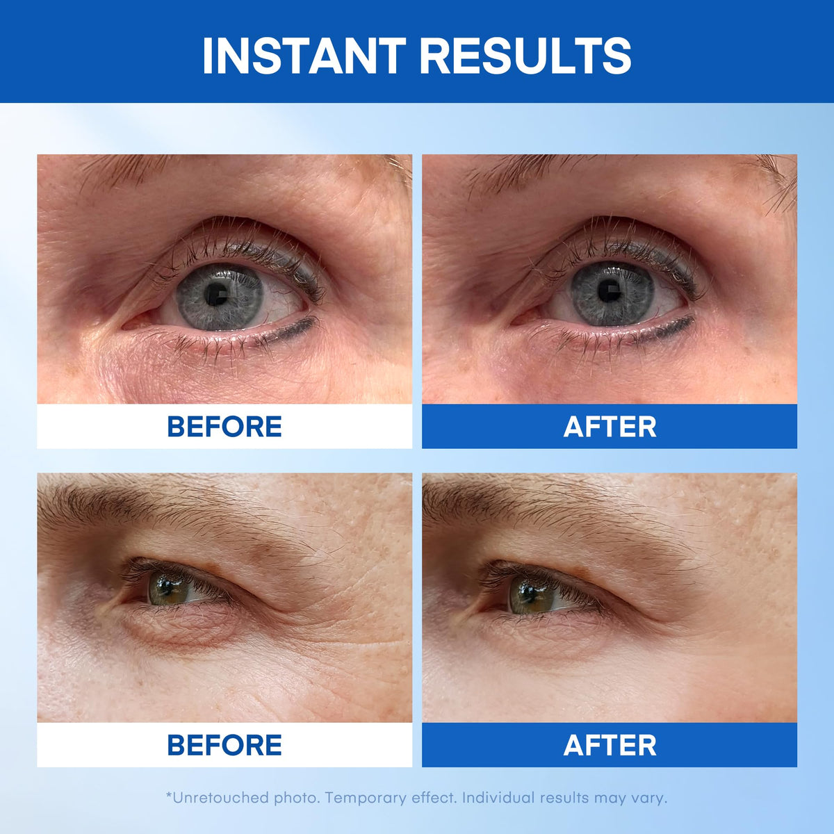 Instant Under Eye Lift Serum - Advanced Firming Polysaccharide (20 Tubes)
