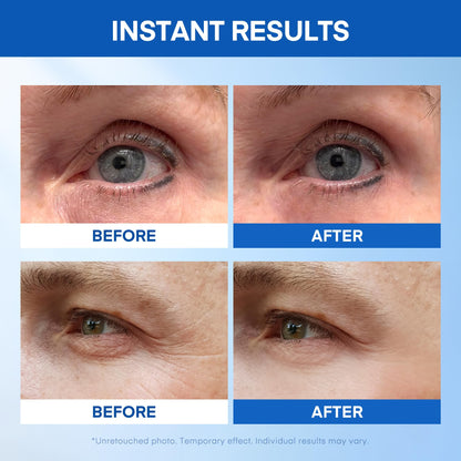 Instant Under Eye Lift Serum - Advanced Firming Polysaccharide (20 Tubes)