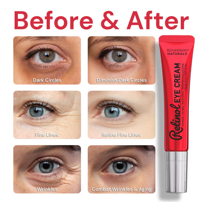 Retinol Eye Cream Anti-Aging - Instant Tightening & Wrinkle Repair (0.85 oz)