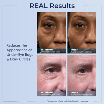 Plexaderm Rapid Reduction Eye Serum - 3 Full Size Tubes - Instant Visible Reduction of Eye Bags, Wrinkles & Dark Circles