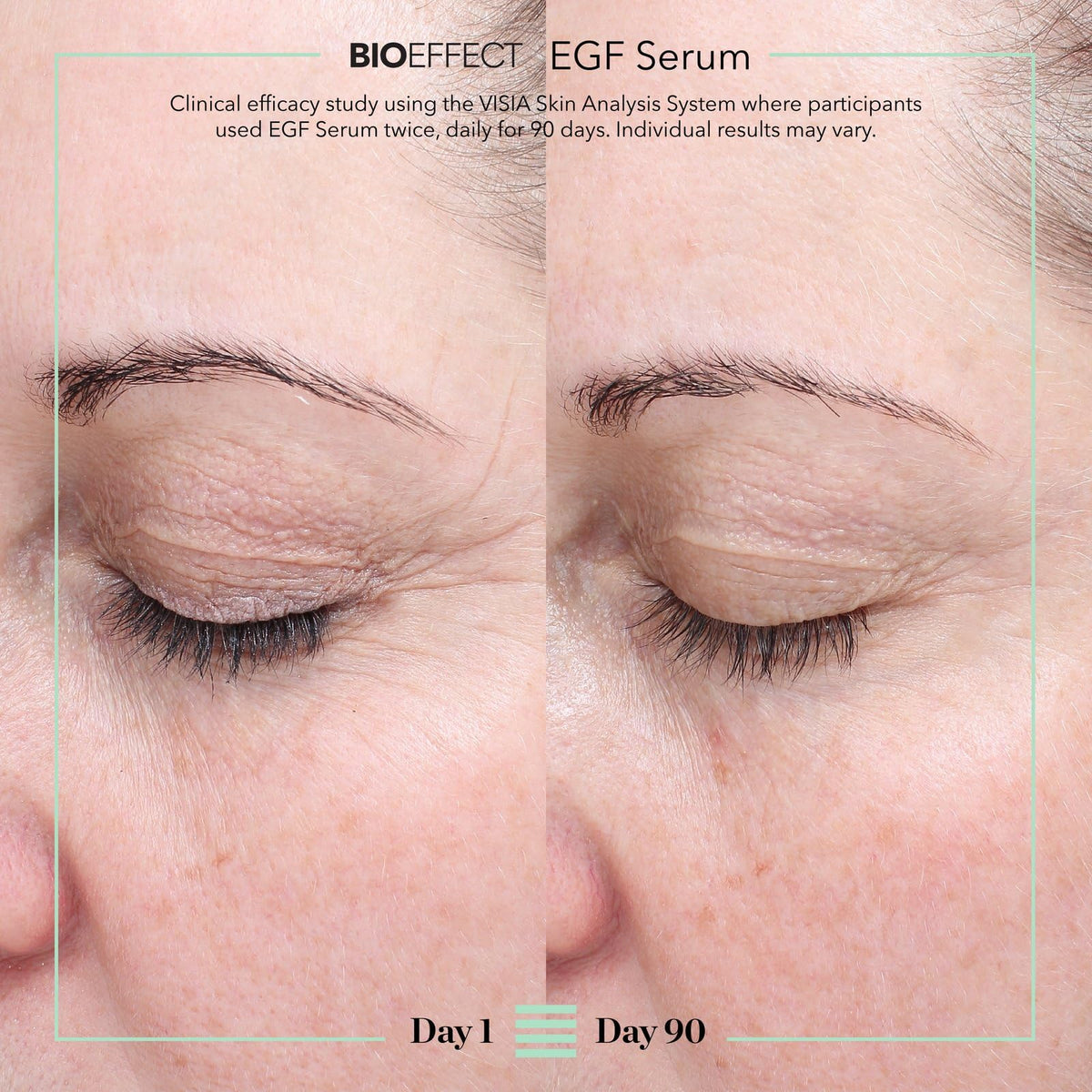 BIOEFFECT EGF Serum - Epidermal Growth Factor + Hyaluronic Acid - Age-Defying Face Treatment for Fine Lines & Wrinkles, Hydration & Firmness, 20 mL / 0.68 oz