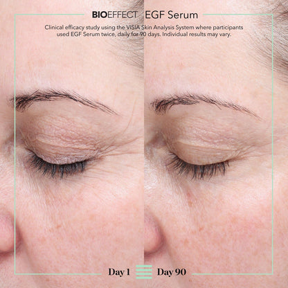 BIOEFFECT EGF Serum - Epidermal Growth Factor + Hyaluronic Acid - Age-Defying Face Treatment for Fine Lines & Wrinkles, Hydration & Firmness, 20 mL / 0.68 oz