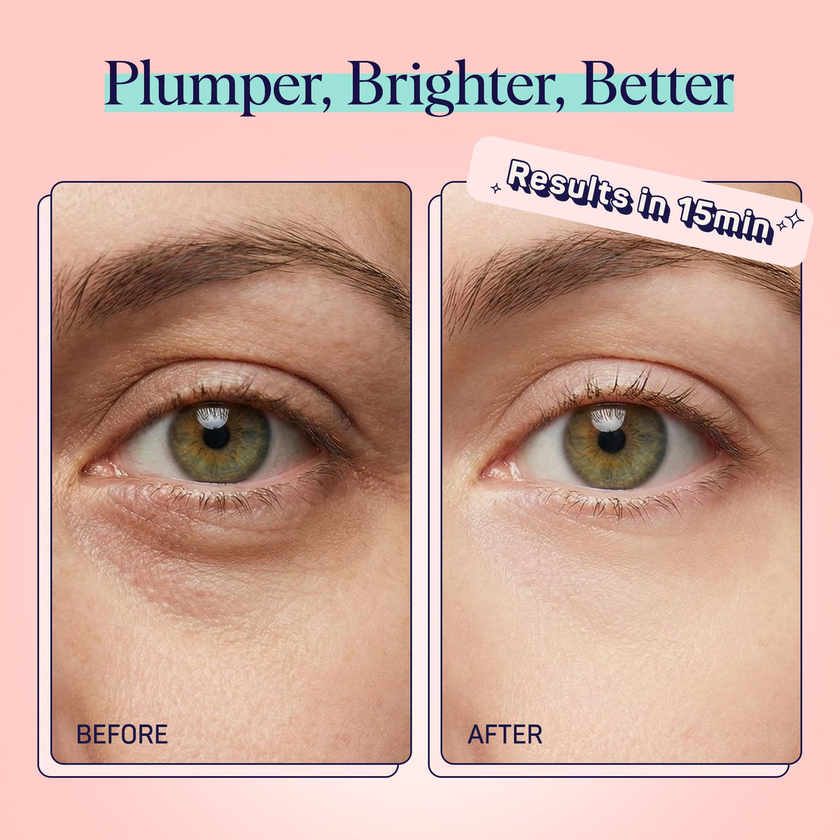 SpaLife Watermelon Cooling Eye Pads - 48 Hydrating Under Eye Patches for Puffiness, Dark Circles & Tired Eyes