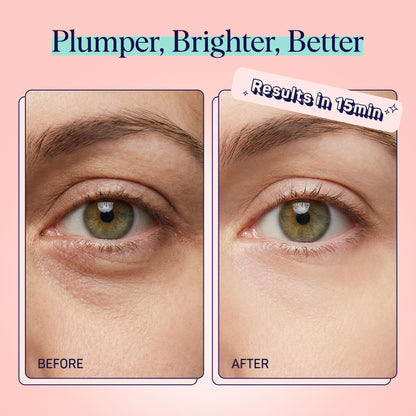 SpaLife Watermelon Cooling Eye Pads - 48 Hydrating Under Eye Patches for Puffiness, Dark Circles & Tired Eyes