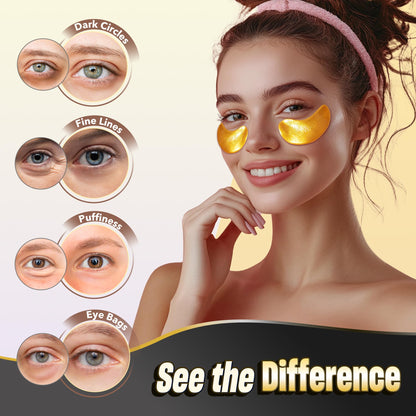 NAZANO 24K Gold Under Eye Patches 102 Pcs for Dark Circles & Puffiness