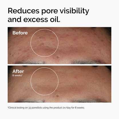 The Ordinary Serum Favorites Set - Hyaluronic Acid 2% + B5, Niacinamide 10% + Zinc 1%, Caffeine Solution 5% - Eye and Face Serums for Hydrating, Brightening & Pore-Minimizing Skin Care