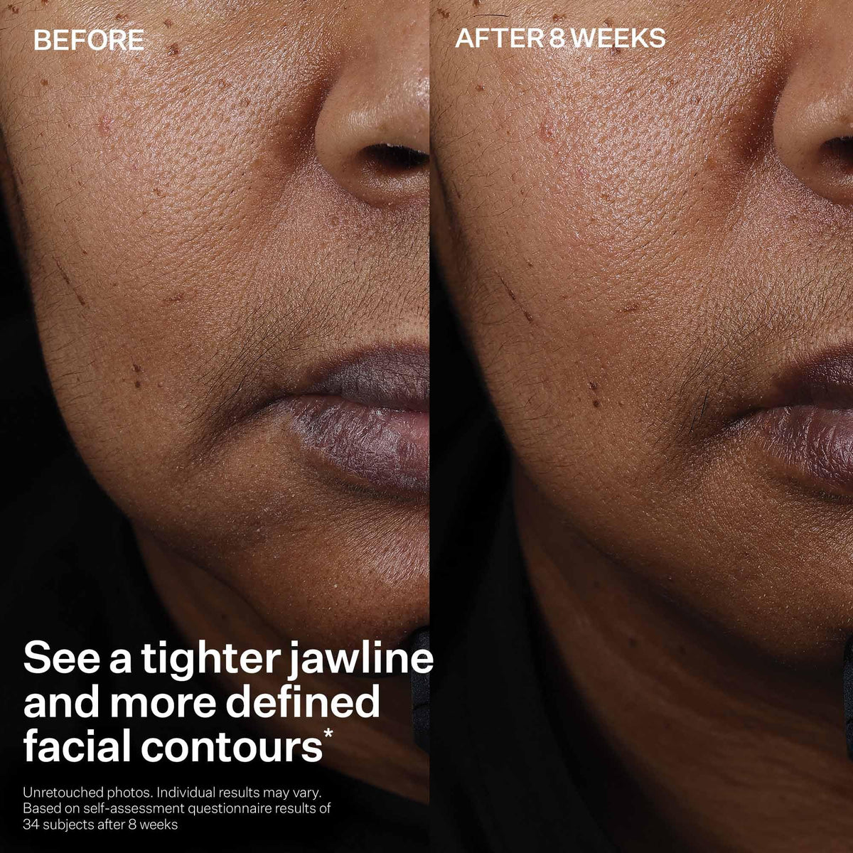 StriVectin Peptight Face Lift Serum (30 mL) - Tightening & Brightening Peptides for Wrinkles and Facial Contours