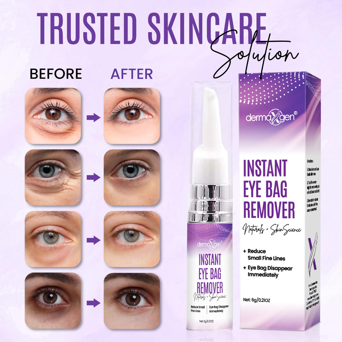 Dermaxgen Instant Under Eye Bag Remover Cream - Dark Circles & Puffiness Treatment, Anti-Aging Eye Cream for Wrinkles and Tired Skin - 0.21 oz