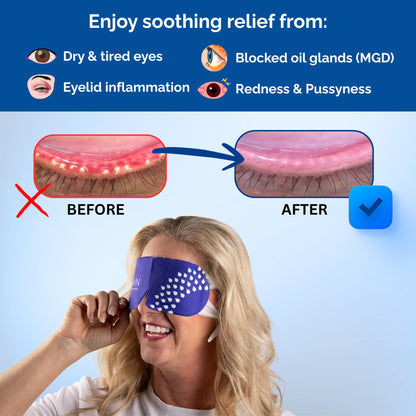 Rain Self Heating Steam Eye Mask - Moist Heat Therapy (20 Masks)