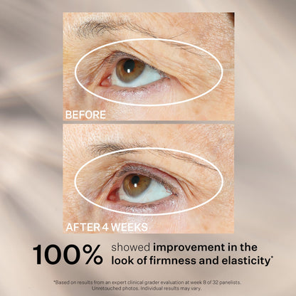 StriVectin Peptight 360° Tightening Eye Serum (1 fl. oz) - Advanced Peptides for Wrinkles, Eye Bags & Sagging Lids