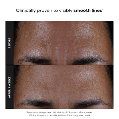 Paulas Choice--SKIN PERFECTING 2% BHA Liquid Salicylic Acid Exfoliant--Facial Exfoliant for Blackheads, Enlarged Pores, Wrinkles & Fine Lines, 4 oz Bottle