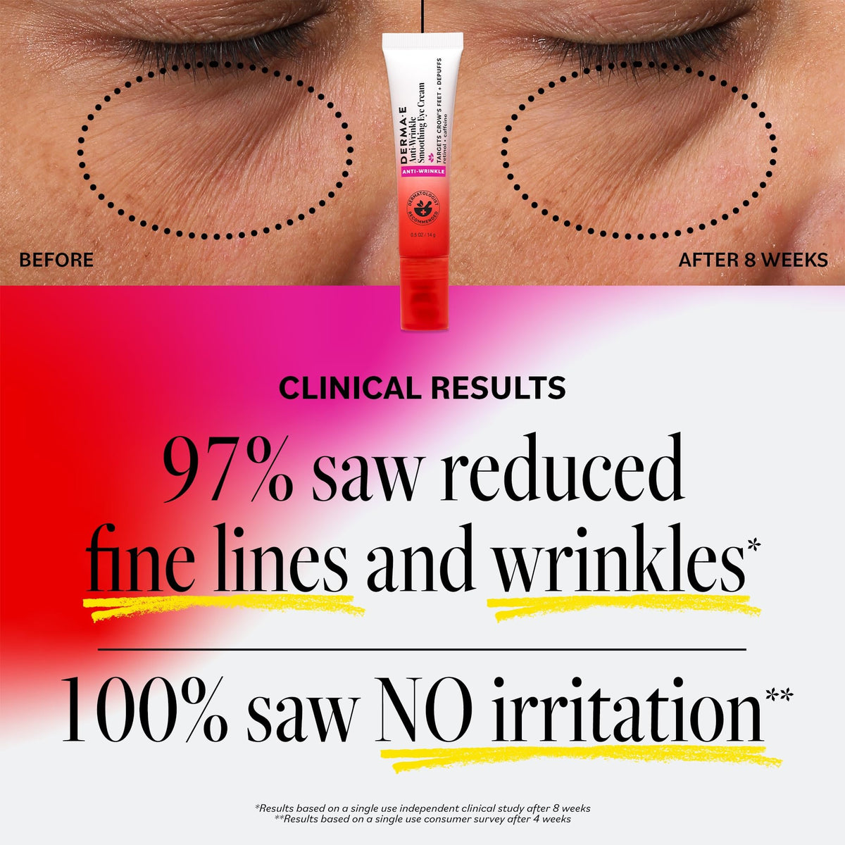 Derma E Anti-Wrinkle Smoothing Eye Cream - Retinol & Caffeine Complex