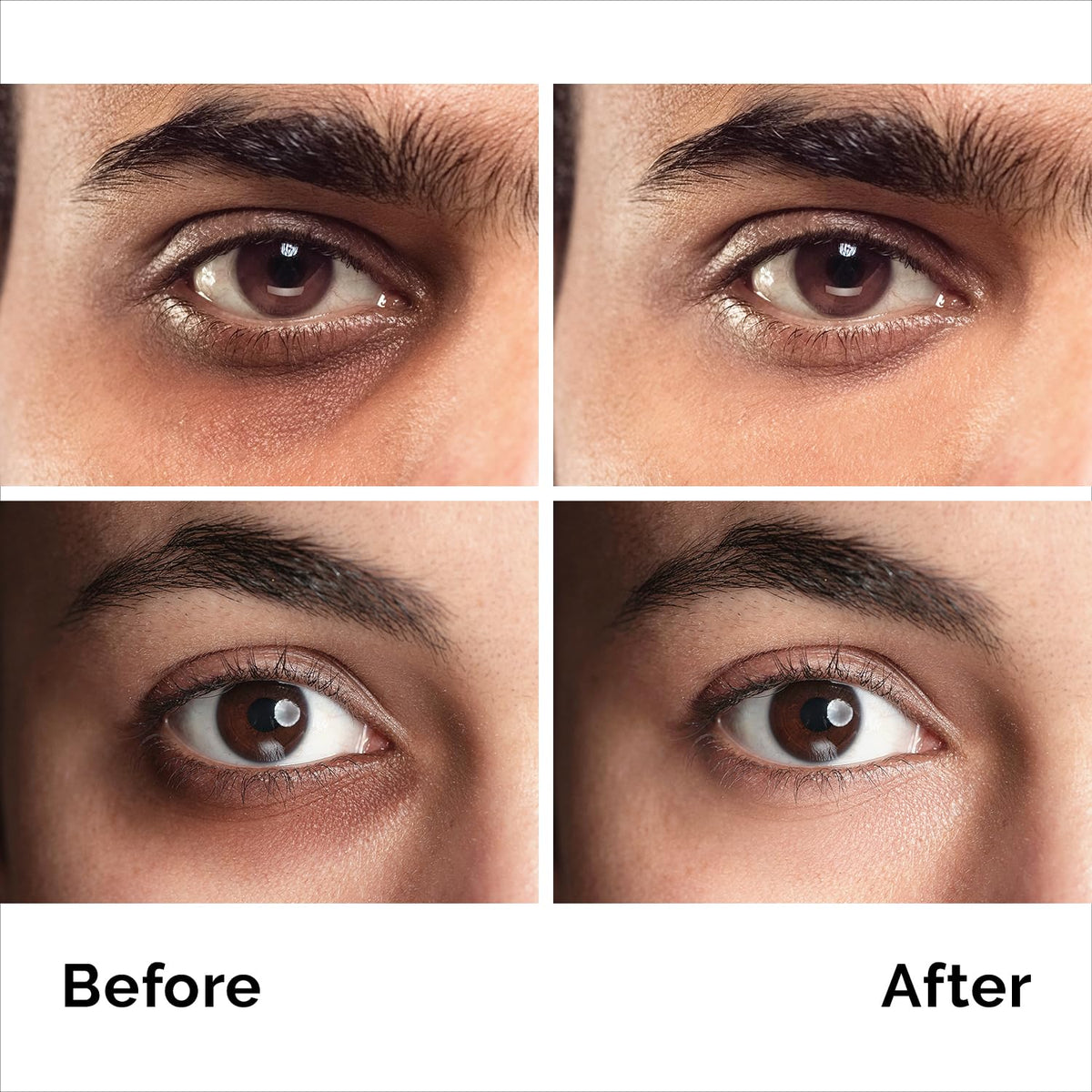 Caffeine Anti-Aging Eye Cream (1.7oz) - Advanced Treatment for Dark Circles, Eye Bags & Puffiness - Instant Face & Eye Lift for Men & Women