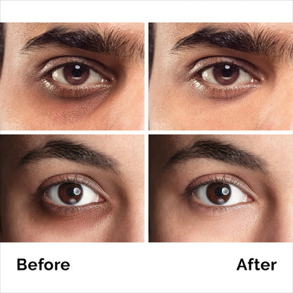 Caffeine Anti-Aging Eye Cream (1.7oz) - Advanced Treatment for Dark Circles, Eye Bags & Puffiness - Instant Face & Eye Lift for Men & Women