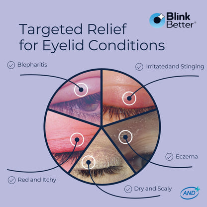 BlinkBetter BetterLids Eyelid Ointment (0.34 oz) - Deep-Moisturizing Oat Complex with Shea Butter & Panthenol for Dry, Itchy & Sensitive Skin
