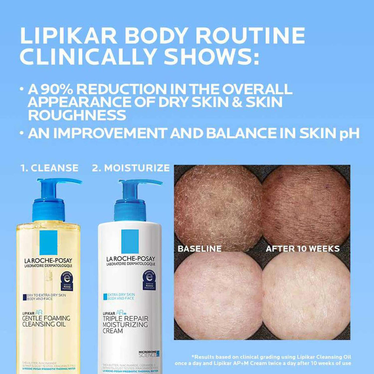 La Roche-Posay Lipikar AP+ Moisturizing Cream for Dry & Sensitive Skin, Shea Butter & Niacinamide