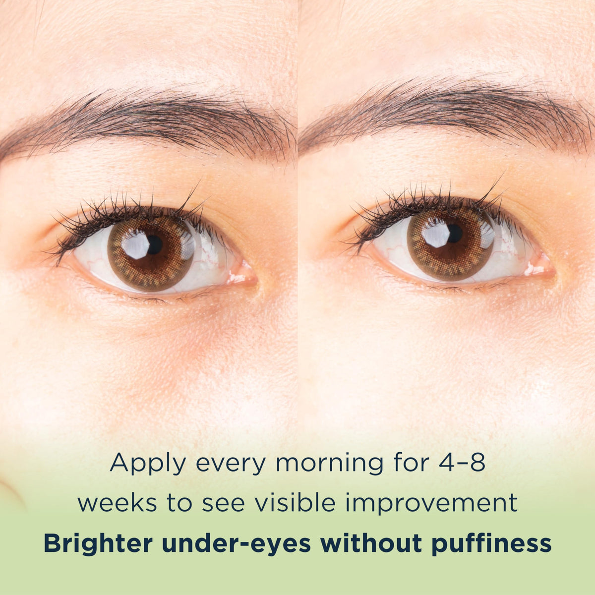 MATKAS Korean Vitamin C Under Eye Cream for Dark Circles & Puffiness (15ml)