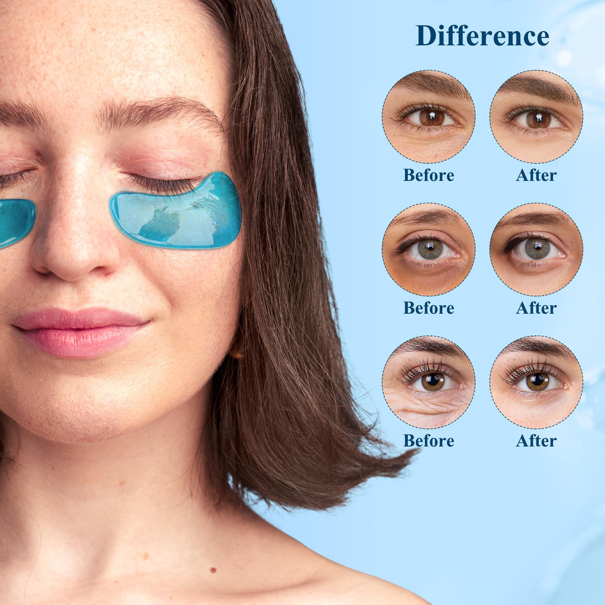 Collagen & Hyaluronic Acid Under Eye Patches - 30 Pairs - Hydrating Eye Mask for Dark Circles, Puffy Eyes & Wrinkles