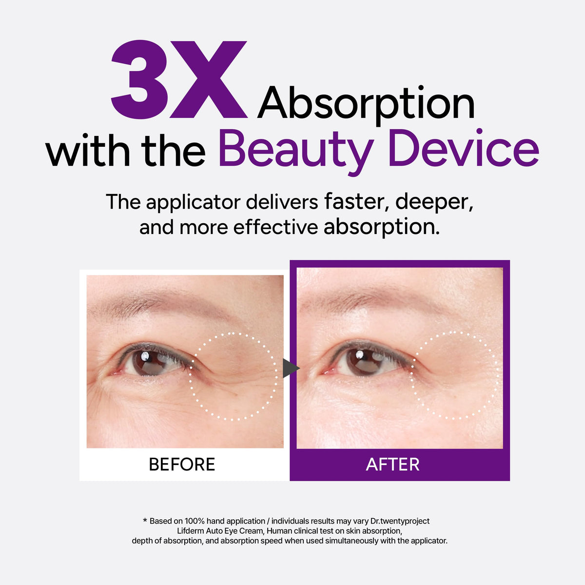 Dr.twentyproject Lifderm Eye Cream with Collagen & Vibrating Device - Korean Lifting & Firming Eye Treatment (0.6 fl oz / 20ml)