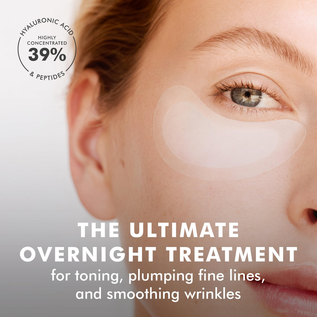 skyn ICELAND Dissolving Microneedle Under-Eye Patches - 39% Hyaluronic Acid & Peptides - Deep Hydration Overnight Mask (3 Pairs)