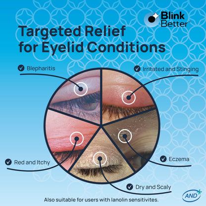BlinkBetter Lanolin-Free Eyelid Ointment (10g) - Soothing & Hydrating Care for Dry, Itchy, Red & Flaky Eyelids