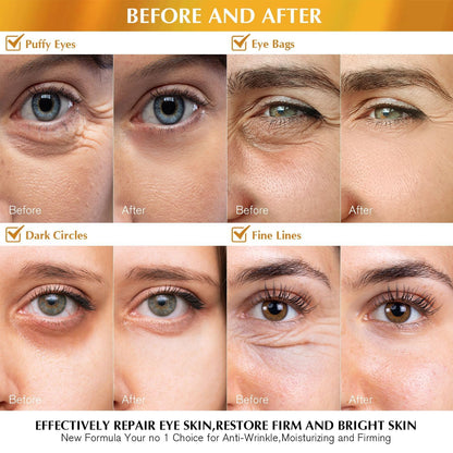 Enaskin Naturals 24K Gold Under Eye Patches (2-PACK / 60 Pairs) - Luxury Collagen & Retinol Eye Mask Gels for Brightening, Wrinkles & Puffiness