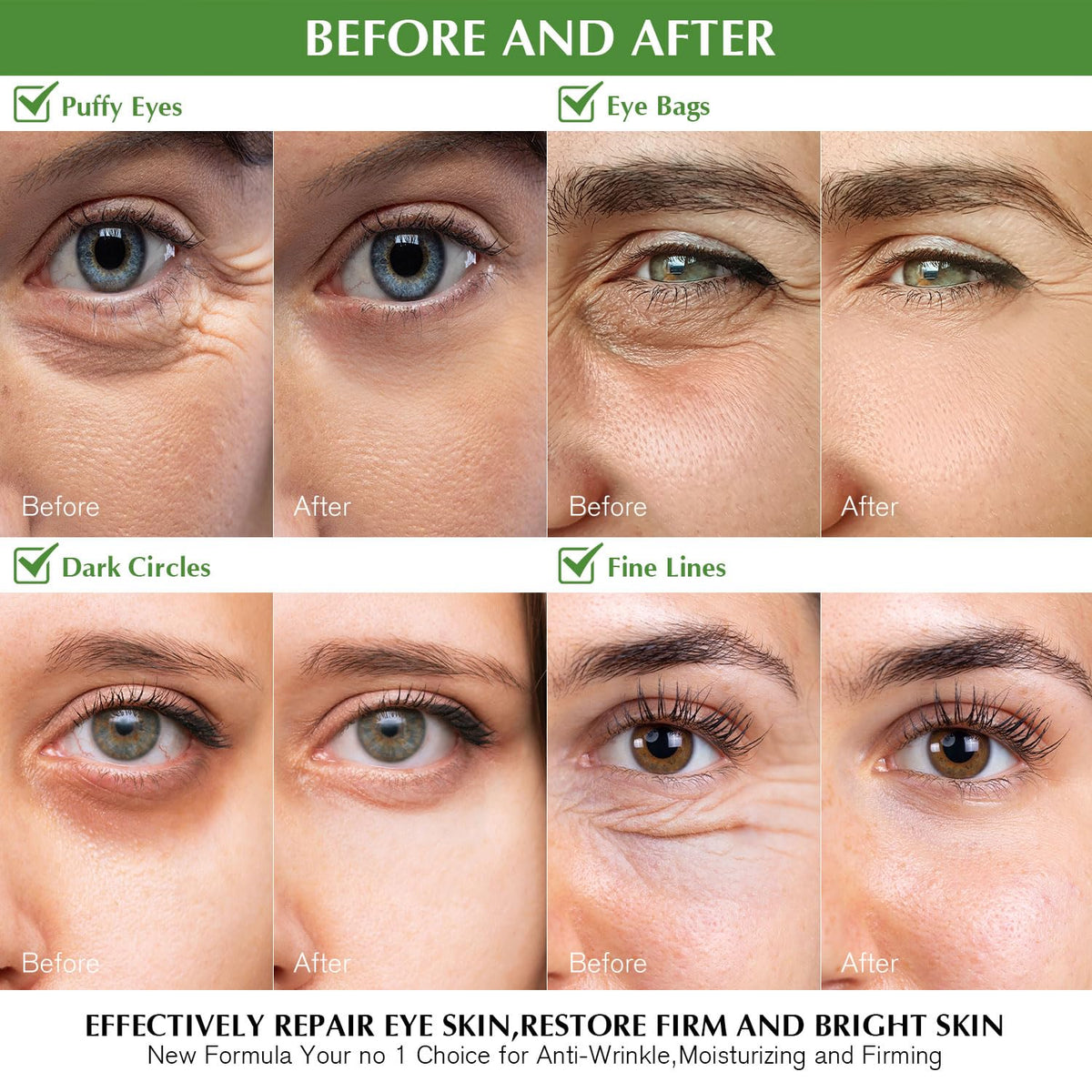 Enaskin Naturals Green Tea Under Eye Patches (30 Pairs) - Antioxidant Eye Gels with Retinol & Collagen for Dark Circles & Puffiness
