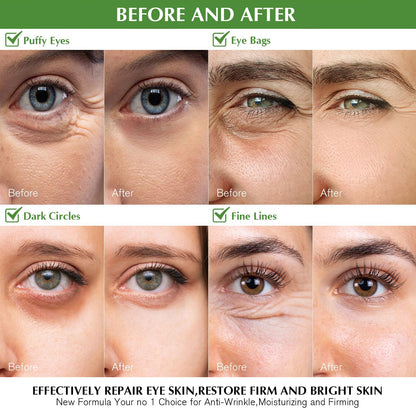 Enaskin Naturals Green Tea Under Eye Patches (30 Pairs) - Antioxidant Eye Gels with Retinol & Collagen for Dark Circles & Puffiness
