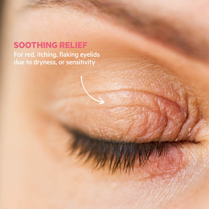 SVR Topialyse Palpebral Eye Cream - Soothing Eye Cream for Dry, Itchy & Sensitive Eyelids 15ml