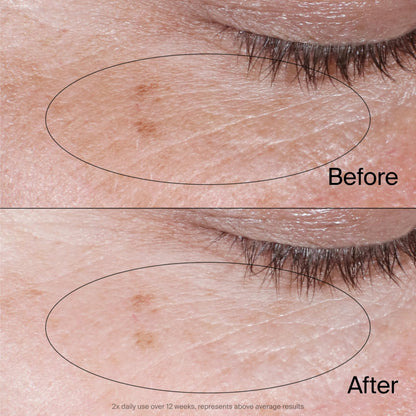Neutrogena Collagen Bank Reviving Eye Cream (0.5 oz) - Fragrance-Free Under Eye Treatment with Peptides to Preserve Collagen
