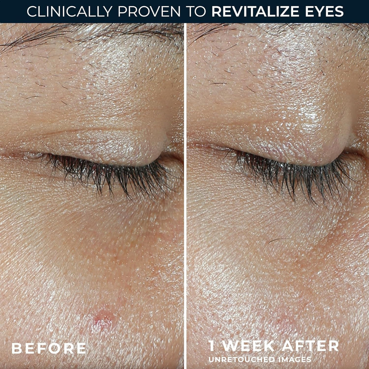 RoC Multi Correxion Revive + Glow Eye Balm (0.14 oz) with Vitamin C - Includes Retinol Eye Cream Sample Packette