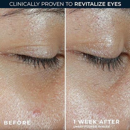 RoC Multi Correxion Revive + Glow Eye Balm (0.14 oz) with Vitamin C - Includes Retinol Eye Cream Sample Packette