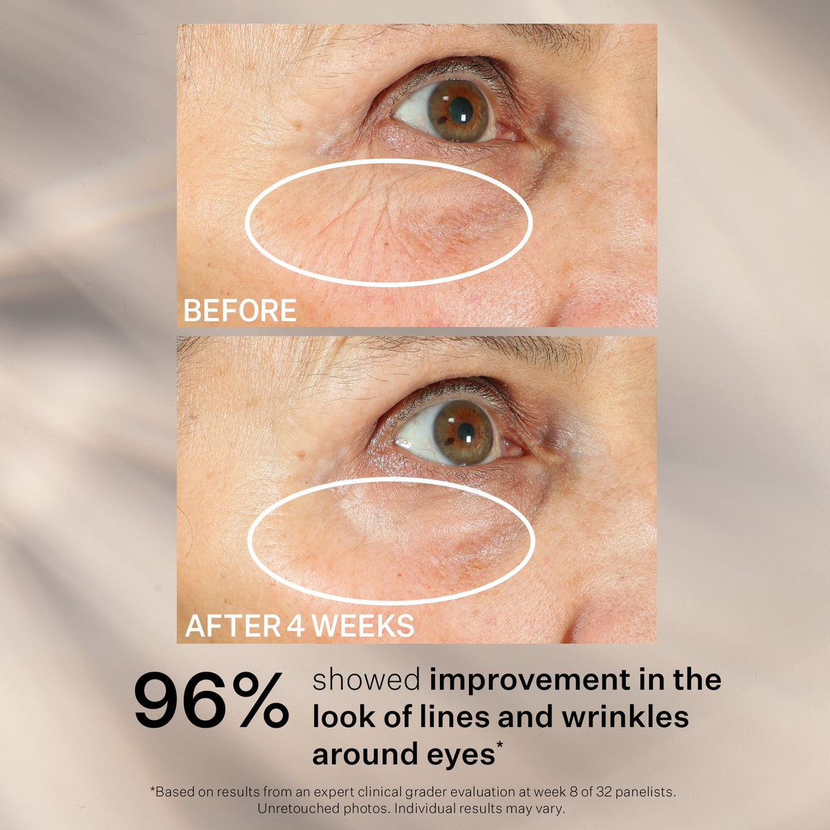 StriVectin Peptight 360° Tightening Eye Serum (1 fl. oz) - Advanced Peptides for Wrinkles, Eye Bags & Sagging Lids
