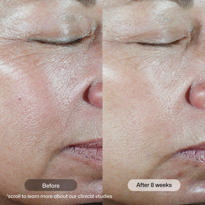 Revision Skincare C+ Correcting Complex 30%, Anti Aging Antioxidant Blend with Vitamin C, Supports Healthy Skin, 1 fl oz