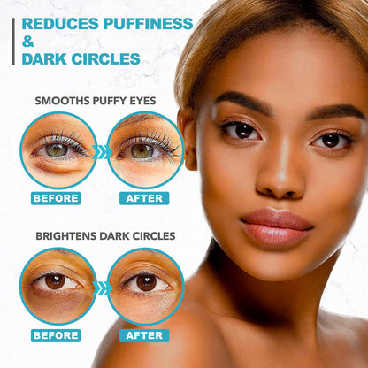 Retinol Collagen Under Eye Patches - Eye Masks for Puffy Eyes, Dark Circles & Wrinkles (60 Gel Pads)