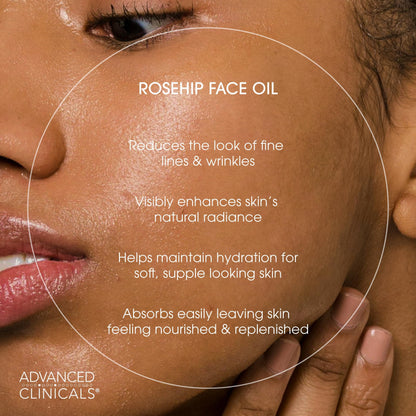 Advanced Clinicals Rosehip Oil Serum - Vitamin E & Botanical Infusion (52ml)