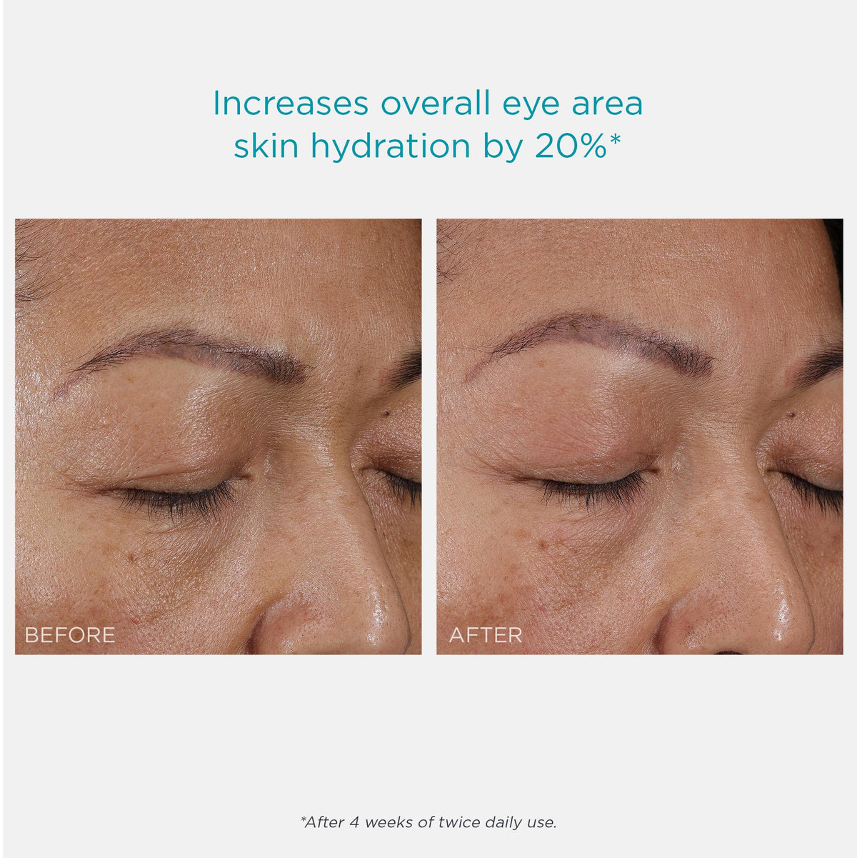 NEOSTRATA RESTORE Hydra Filling PHA Eye Cream - 15g (0.5 oz) - Anti-Aging & Lifting Treatment with Hyaluronic Acid & Vitamin C