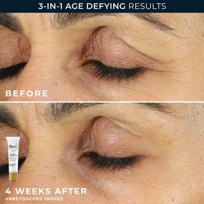 RoC Retinol Correxion Value Set Duo Night Cream + Under Eye Cream
