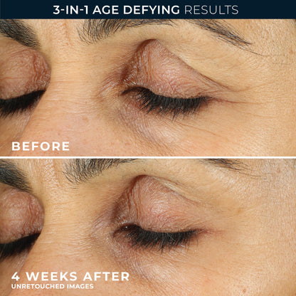 RoC Retinol Correxion Eye Cream (0.25 oz) - Mini Anti-Aging Treatment for Wrinkles, Dark Circles & Puffiness