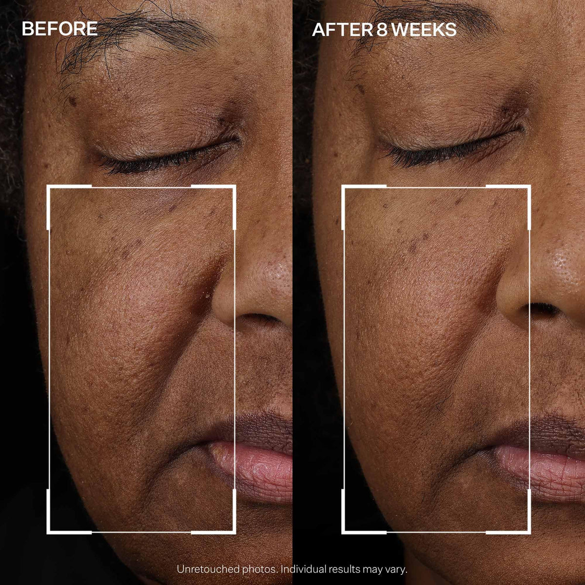 StriVectin Peptight Face Lift Serum (30 mL) - Tightening & Brightening Peptides for Wrinkles and Facial Contours