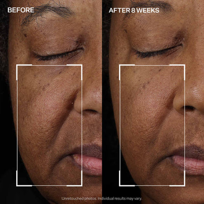 StriVectin Peptight Face Lift Serum (30 mL) - Tightening & Brightening Peptides for Wrinkles and Facial Contours