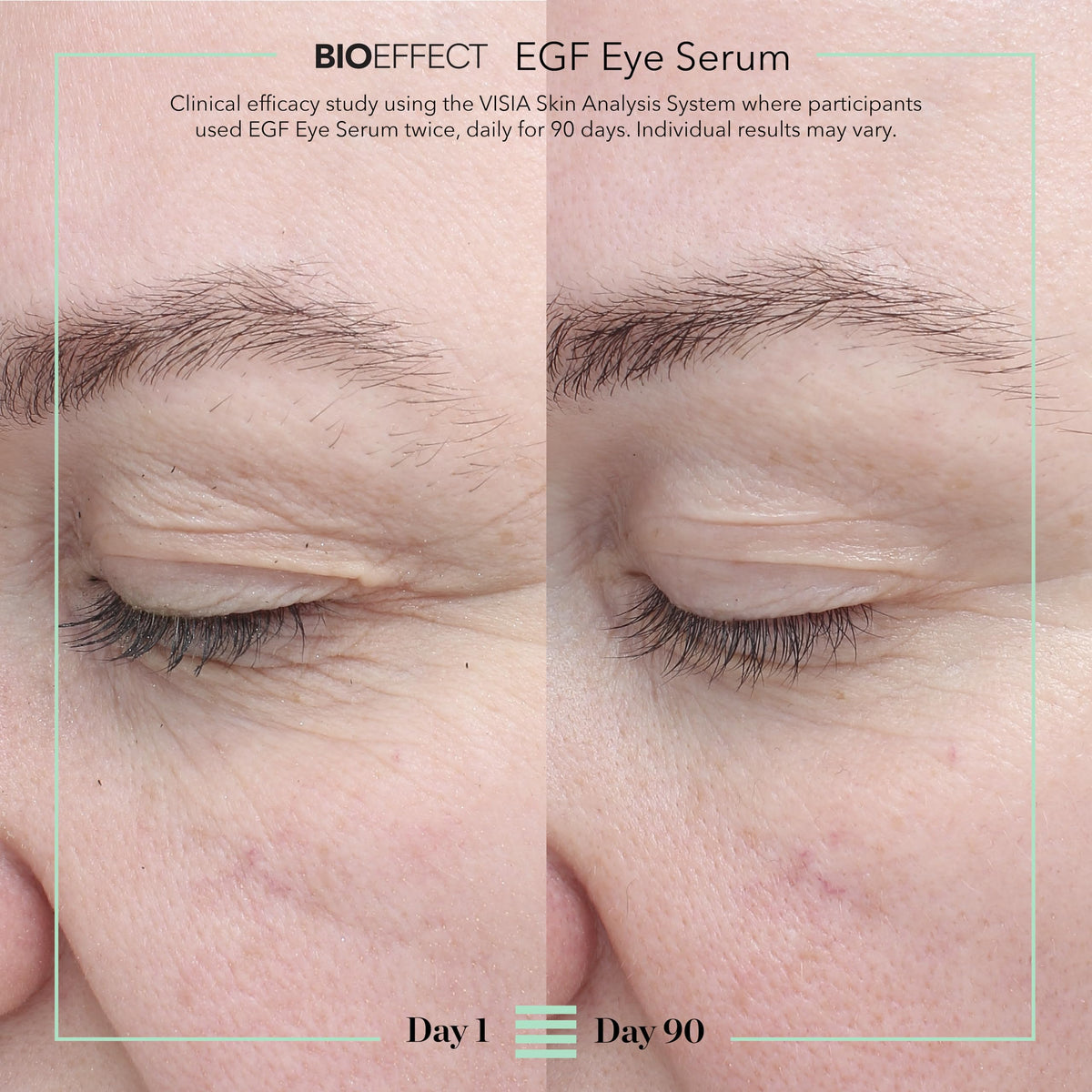BIOEFFECT EGF Eye Serum (6mL) - Age-Defying Under Eye Treatment with De-Puffing Rollerball & Barley EGF