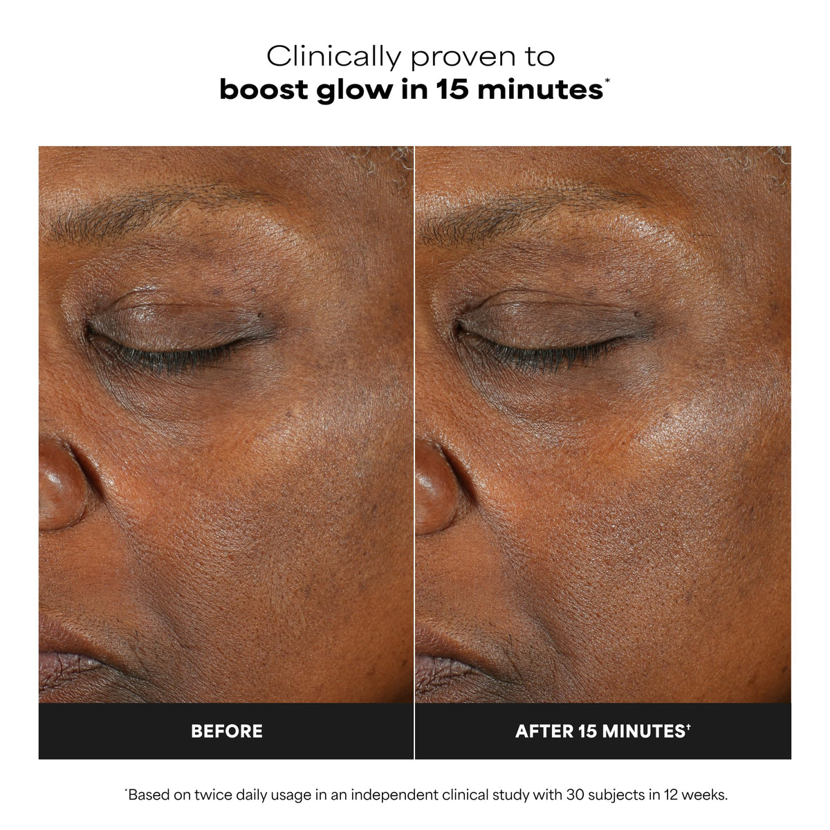 Paula's Choice BOOST C15 Super Booster, 15% Vitamin C Serum for Face, Face Serum with Vitamin E & Ferulic Acid for Discoloration & Glow, Fragrance-Free, 0.67 Fl Oz