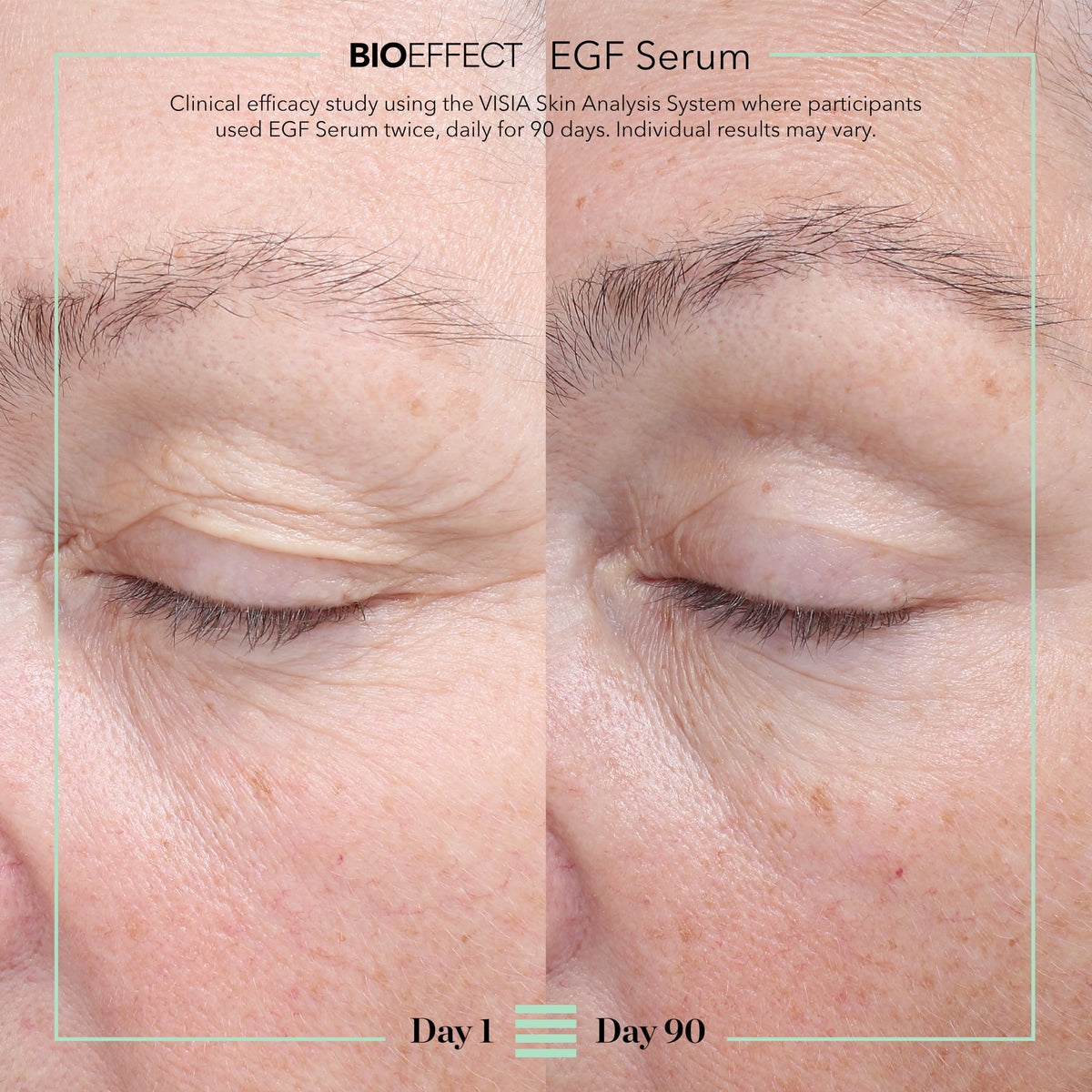 BIOEFFECT EGF Serum - Epidermal Growth Factor + Hyaluronic Acid - Age-Defying Face Treatment for Fine Lines & Wrinkles, Hydration & Firmness, 20 mL / 0.68 oz